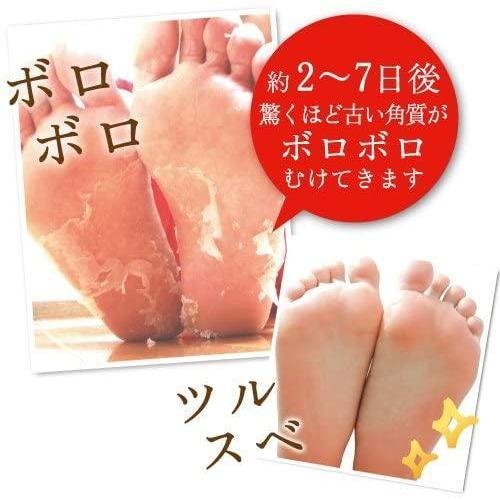 P-4-LBT-BBFEXF-S30-Liberta Baby Foot Exfoliation Foot Peel 30 Minutes Treatment - Size S.jpg